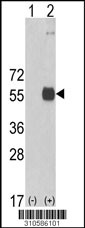 Western blot analysis of his-tag LHX2 (arrow) using his tag antibody. 293 cell lysates (2 ug/lane) either nontransfected (Lane 1) or transiently transfected with the LHX2 gene (Lane 2, Cat. #LY10586a).