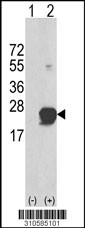 Western blot analysis of his-tag GSTA1 (arrow) using his tag antibody. 293 cell lysates (2 ug/lane) either nontransfected (Lane 1) or transiently transfected with the GSTA1 gene (Lane 2, Cat. #LY10585a).