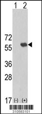 Western blot analysis of his-tag ATG4C (arrow) using his tag antibody. 293 cell lysates (2 ug/lane) either nontransfected (Lane 1) or transiently transfected with the ATG4C gene (Lane 2, Cat. #LY10583a).