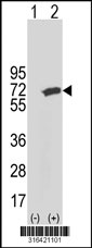 Western blot analysis of his-tag C6orf150 (arrow) using his tag antibody. 293T cell lysates (2 ug/lane) either nontransfected (Lane 1) or transiently transfected with the C6orf150 gene‘