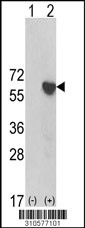 Western blot analysis of his-tag ARIH2 (arrow) using his tag antibody. 293 cell lysates (2 ug/lane) either nontransfected (Lane 1) or transiently transfected with the ARIH2 gene (Lane 2, Cat. #LY10577a).