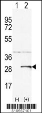 Western blot analysis of his-tag ANAPC10 (arrow) using his tag antibody. 293 cell lysates (2 ug/lane) either nontransfected (Lane 1) or transiently transfected with the ANAPC10 gene