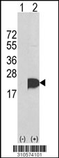 Western blot analysis of his-tag UBE2H (arrow) using his tag antibody. 293 cell lysates (2 ug/lane) either nontransfected (Lane 1) or transiently transfected with the UBE2H gene (Lane 2, Cat. #LY10574a).