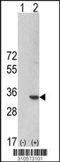 Western blot analysis of his-tag PSMB10 (arrow) using his tag antibody. 293 cell lysates (2 ug/lane) either nontransfected (Lane 1) or transiently transfected with the PSMB10 gene (Lane 2, Cat. #LY10573a).