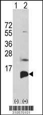 Western blot analysis of his-tag PF4 (arrow) using his tag antibody. 293 cell lysates (2 ug/lane) either nontransfected (Lane 1) or transiently transfected with the PF4 gene (Lane 2, Cat. #LY10570a).