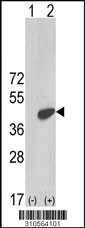 Western blot analysis of his-tag DUSP4 (arrow) using his tag antibody. 293 cell lysates (2 ug/lane) either nontransfected (Lane 1) or transiently transfected with the DUSP4 gene (Lane 2, Cat. #LY10564a).