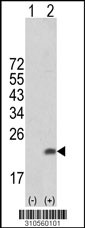 Western blot analysis of his-tag USP47 (arrow) using his tag antibody. 293 cell lysates (2 ug/lane) either nontransfected (Lane 1) or transiently transfected with the USP47 gene (Lane 2, Cat. #LY10560a).