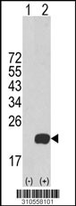 Western blot analysis of his-tag UBE2I (arrow) using his tag antibody. 293 cell lysates (2 ug/lane) either nontransfected (Lane 1) or transiently transfected with the UBE2I gene (Lane 2, Cat. #LY10558a).