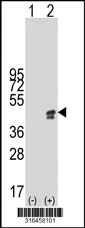 Western blot analysis of his-tag GFOD1 (arrow) using his tag antibody. 293T cell lysates (2 ug/lane) either nontransfected (Lane 1) or transiently transfected with the GFOD1 gene‘