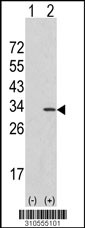 Western blot analysis of his-tag PSMB5 (arrow) using his tag antibody. 293 cell lysates (2 ug/lane) either nontransfected (Lane 1) or transiently transfected with the PSMB5 gene (Lane 2, Cat. #LY10555a).