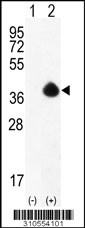 Western blot analysis of his-tag RNF144B (arrow) using his tag antibody. 293 cell lysates (2 ug/lane) either nontransfected (Lane 1) or transiently transfected with the RNF144B gene