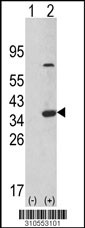 Western blot analysis of his-tag PSMB8 (arrow) using his tag antibody. 293 cell lysates (2 ug/lane) either nontransfected (Lane 1) or transiently transfected with the PSMB8 gene (Lane 2, Cat. #LY10553a).
