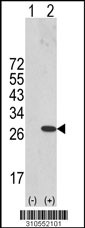 Western blot analysis of his-tag PCNP (arrow) using his tag antibody. 293 cell lysates (2 ug/lane) either nontransfected (Lane 1) or transiently transfected with the PCNP gene (Lane 2, Cat. #LY10552a).