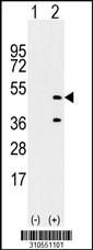 Western blot analysis of his-tag PARK2 (arrow) using his tag antibody. 293 cell lysates (2 ug/lane) either nontransfected (Lane 1) or transiently transfected with the PARK2 gene