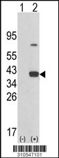 Western blot analysis of his-tag PPTC7 (arrow) using his tag antibody. 293 cell lysates (2 ug/lane) either nontransfected (Lane 1) or transiently transfected with the PPTC7 gene (Lane 2, Cat. #LY10547a).