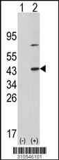 Western blot analysis of his-tag PPP6C (arrow) using his tag antibody. 293 cell lysates (2 ug/lane) either nontransfected (Lane 1) or transiently transfected with the PPP6C gene (Lane 2, Cat. #LY10546a).