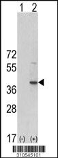 Western blot analysis of his-tag PPP1CB (arrow) using his tag antibody. 293 cell lysates (2 ug/lane) either nontransfected (Lane 1) or transiently transfected with the PPP1CB gene (Lane 2, Cat. #LY10545a).