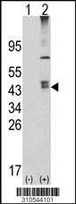 Western blot analysis of his-tag PPAP2B (arrow) using his tag antibody. 293 cell lysates (2 ug/lane) either nontransfected (Lane 1) or transiently transfected with the PPAP2B gene (Lane 2, Cat. #LY10544a).