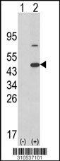 Western blot analysis of his-tag PPP1CA (arrow) using his tag antibody. 293 cell lysates (2 ug/lane) either nontransfected (Lane 1) or transiently transfected with the PPP1CA gene (Lane 2, Cat. #LY10537a).