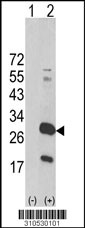 Western blot analysis of his-tag IL28B (arrow) using his tag antibody. 293 cell lysates (2 ug/lane) either nontransfected (Lane 1) or transiently transfected with the IL28B gene (Lane 2, Cat. #LY10530a).