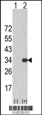 Western blot analysis of his-tag IFNA8 (arrow) using his tag antibody. 293 cell lysates (2 ug/lane) either nontransfected (Lane 1) or transiently transfected with the IFNA8 gene (Lane 2, Cat. #LY10528a).