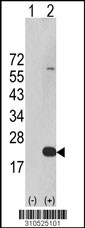 Western blot analysis of his-tag IL1F8 (arrow) using his tag antibody. 293 cell lysates (2 ug/lane) either nontransfected (Lane 1) or transiently transfected with the IL1F8 gene (Lane 2, Cat. #LY10525a).