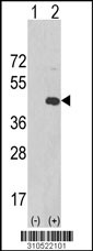 Western blot analysis of his-tag PLK5P (arrow) using his tag antibody. 293 cell lysates (2 ug/lane) either nontransfected (Lane 1) or transiently transfected with the PLK5P gene (Lane 2, Cat. #LY10522a).