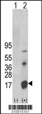 Western blot analysis of his-tag CCL7 (arrow) using his tag antibody. 293 cell lysates (2 ug/lane) either nontransfected (Lane 1) or transiently transfected with the CCL7 gene (Lane 2, Cat. #LY10515a).