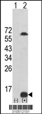 Western blot analysis of his-tag CCL4L1 (arrow) using his tag antibody. 293 cell lysates (2 ug/lane) either nontransfected (Lane 1) or transiently transfected with the CCL4L1 gene (Lane 2, Cat. #LY10512a).