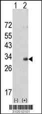 Western blot analysis of his-tag IFNA14 (arrow) using his tag antibody. 293 cell lysates (2 ug/lane) either nontransfected (Lane 1) or transiently transfected with the IFNA14 gene (Lane 2, Cat. #LY10510a).