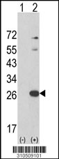 Western blot analysis of his-tag IFNA7 (arrow) using his tag antibody. 293 cell lysates (2 ug/lane) either nontransfected (Lane 1) or transiently transfected with the IFNA7 gene (Lane 2, Cat. #LY10509a).