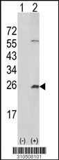 Western blot analysis of his-tag IFNA4 (arrow) using his tag antibody. 293 cell lysates (2 ug/lane) either nontransfected (Lane 1) or transiently transfected with the IFNA4 gene (Lane 2, Cat. #LY10508a).