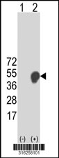Western blot analysis of his-tag C4orf16 (arrow) using his tag antibody. 293T cell lysates (2 ug/lane) either nontransfected (Lane 1) or transiently transfected with the C4orf16 gene‘