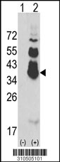 Western blot analysis of his-tag CXCL16 (arrow) using his tag antibody. 293 cell lysates (2 ug/lane) either nontransfected (Lane 1) or transiently transfected with the CXCL16 gene (Lane 2, Cat. #LY10505a).