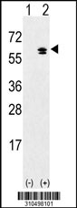 Western blot analysis of his-tag USP30 (arrow) using his tag antibody. 293 cell lysates (2 ug/lane) either nontransfected (Lane 1) or transiently transfected with the USP30 gene