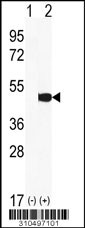 Western blot analysis of his-tag PINK1 (arrow) using his tag antibody. 293 cell lysates (2 ug/lane) either nontransfected (Lane 1) or transiently transfected with the PINK1 gene