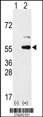 Western blot analysis of his-tag EYA2 (arrow) using his tag antibody. 293 cell lysates (2 ug/lane) either nontransfected (Lane 1) or transiently transfected with the EYA2 gene