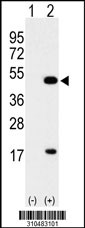 Western blot analysis of his-tag PPARD (arrow) using his tag antibody. 293 cell lysates (2 ug/lane) either nontransfected (Lane 1) or transiently transfected with the PPARD gene
