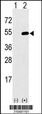Western blot analysis of his-tag IPMK (arrow) using his tag antibody. 293 cell lysates (2 ug/lane) either nontransfected (Lane 1) or transiently transfected with the IPMK gene