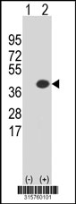 Western blot analysis of his-tag CCDC50 (arrow) using his tag antibody. 293T cell lysates (2 ug/lane) either nontransfected (Lane 1) or transiently transfected with the CCDC50 gene‘