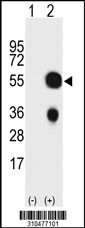 Western blot analysis of his-tag LMX1B (arrow) using his tag antibody. 293 cell lysates (2 ug/lane) either nontransfected (Lane 1) or transiently transfected with the LMX1B gene