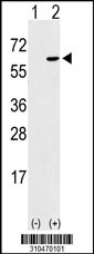 Western blot analysis of his-tag STK38 (arrow) using his tag antibody. 293 cell lysates (2 ug/lane) either nontransfected (Lane 1) or transiently transfected with the STK38 gene