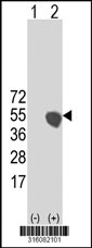 Western blot analysis of his-tag C3orf54 (arrow) using his tag antibody. 293T cell lysates (2 ug/lane) either nontransfected (Lane 1) or transiently transfected with the C3orf54 gene‘