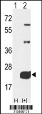 Western blot analysis of his-tag RFK (arrow) using his tag antibody. 293 cell lysates (2 ug/lane) either nontransfected (Lane 1) or transiently transfected with the RFK gene