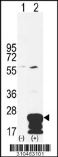 Western blot analysis of his-tag IL17B (arrow) using his tag antibody. 293 cell lysates (2 ug/lane) either nontransfected (Lane 1) or transiently transfected with the IL17B gene