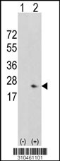 Western blot analysis of his-tag IL22 (arrow) using his tag antibody. 293 cell lysates (2 ug/lane) either nontransfected (Lane 1) or transiently transfected with the IL22 gene (Lane 2, Cat. #LY10461a).