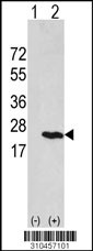 Western blot analysis of his-tag CSH2 (arrow) using his tag antibody. 293 cell lysates (2 ug/lane) either nontransfected (Lane 1) or transiently transfected with the CSH2 gene (Lane 2, Cat. #LY10457a).