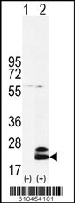 Western blot analysis of his-tag IFNB1 (arrow) using his tag antibody. 293 cell lysates (2 ug/lane) either nontransfected (Lane 1) or transiently transfected with the IFNB1 gene