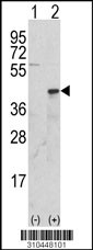 Western blot analysis of his-tag FASLG (arrow) using his tag antibody. 293 cell lysates (2 ug/lane) either nontransfected (Lane 1) or transiently transfected with the FASLG gene (Lane 2, Cat. #LY10448a).