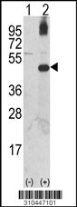 Western blot analysis of his-tag WNT16 (arrow) using his tag antibody. 293 cell lysates (2 ug/lane) either nontransfected (Lane 1) or transiently transfected with the WNT16 gene (Lane 2, Cat. #LY10447a).